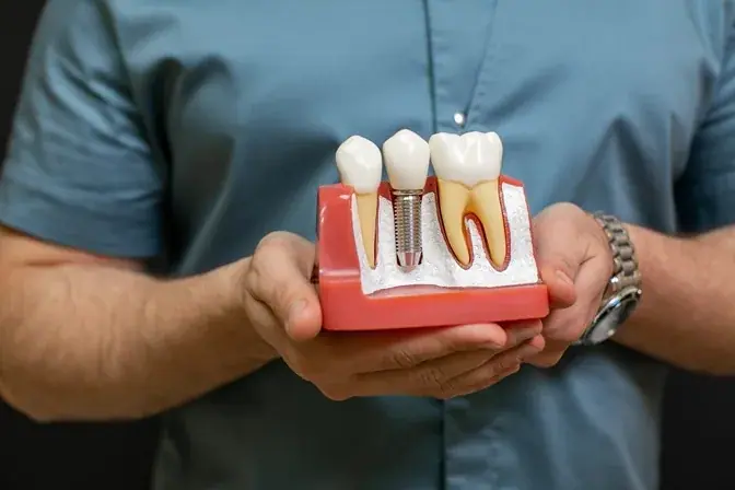 Dentist holding a model of a dental implant next to natural teeth