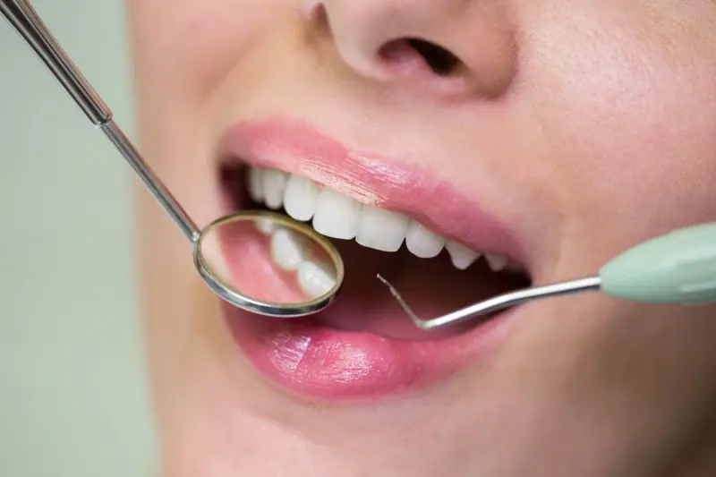 Dentist checking a patient's teeth with a mirror